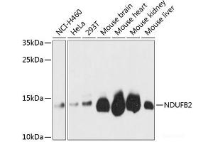 Western blot analysis of extracts of various cell lines using NDUFB2 Polyclonal Antibody at dilution of 1:3000. (NDUFB2 抗体)