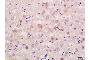 Formalin-fixed and paraffin embedded rat brain labeled with Rabbit Anti CD56/NCAM1 Polyclonal Antibody, Unconjugated (ABIN728398) at 1:200 followed by conjugation to the secondary antibody and DAB staining (CD56 抗体  (AA 621-720))