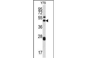 Western blot analysis of ARPC1A antibody in Y79 cell line lysates (35ug/lane) (ARPC1A 抗体  (AA 157-184))