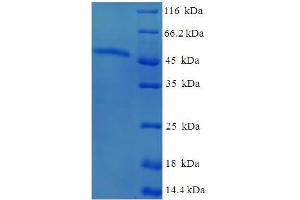 SDS-PAGE (SDS) image for AKT Interacting Protein (AKTIP) (AA 1-292), (full length) protein (His-SUMO Tag) (ABIN5711761)