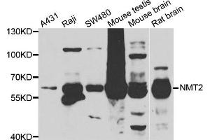 Western blot analysis of extracts of various cell lines, using NMT2 antibody. (NMT2 抗体)