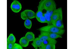 MCF-7 cells were stained with Smad1 (2D9) Monoclonal Antibody  at [1:200] incubated overnight at 4C, followed by secondary antibody incubation, DAPI staining of the nuclei and detection.