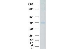 Validation with Western Blot