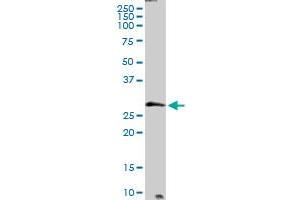 PTPLB MaxPab rabbit polyclonal antibody. (PTPLB 抗体  (AA 1-254))