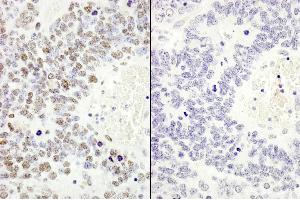 Immunohistochemistry (IHC) image for anti-Minichromosome Maintenance Complex Component 2 (MCM2) (pSer53) antibody (ABIN7448649)