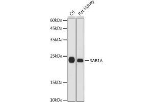 Western blot analysis of extracts of various cell lines, using RA antibody (ABIN7269798) at 1:1000 dilution. (RAB1A 抗体  (AA 1-205))