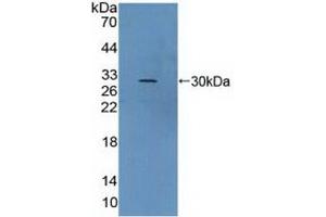 Detection of Recombinant vWA2, Human using Polyclonal Antibody to Von Willebrand Factor A Domain Containing Protein 2 (vWA2) (VWA2 抗体  (AA 457-708))