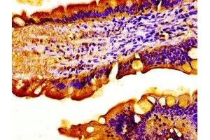 Immunohistochemistry of paraffin-embedded human small intestine tissue using ABIN7175433 at dilution of 1:100 (ACADVL 抗体  (AA 403-497))