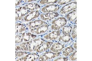 Immunohistochemistry of paraffin-embedded rat stomach using USP5 Rabbit pAb (ABIN1683231, ABIN3018687, ABIN3018688 and ABIN6220542) at dilution of 1:100 (40x lens). (USP5 抗体  (AA 1-280))