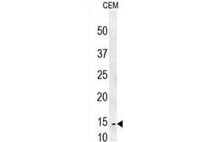 CRCT1 Antibody (N-term) western blot analysis in CEM cell line lysates (35µg/lane). (CRCT1 抗体  (N-Term))