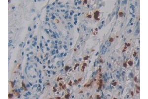 Immunohistochemistry (IHC) image for anti-Defensin, alpha 4, Corticostatin (DEFA4) (AA 23-97) antibody (ABIN7441130)