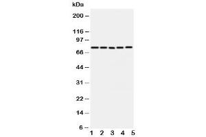 Western blot testing of ABCG1 antibody and Lane 1:  U87 (ABCG1 抗体  (C-Term))
