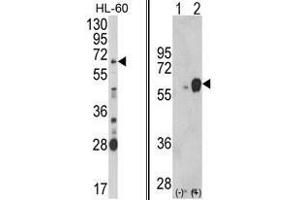 (LEFT) Western blot analysis of ARSB Antibody (Center) in HL-60 cell line lysates (35ug/lane). (Arylsulfatase B 抗体  (Middle Region))