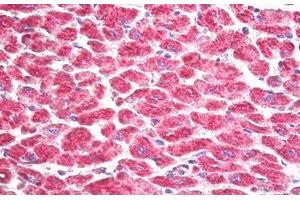 Immunohistochemistry (IHC) image for anti-Ribosomal Protein S6 Kinase, 90kDa, Polypeptide 5 (RPS6KA5) (AA 551-600) antibody (ABIN2879102)
