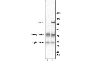 STAT2 antibody (pAb) tested by Immunoprecipitation.
