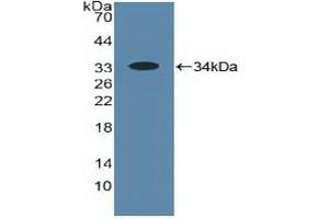 Detection of Recombinant ALOX5, Human using Polyclonal Antibody to 5-Lipoxygenase (5-LO) (ALOX5 抗体  (AA 461-671))