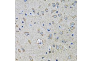 Immunohistochemistry of paraffin-embedded mouse brain using SSBP1 antibody (ABIN5974202) at dilution of 1/100 (40x lens). (SSBP1 抗体)
