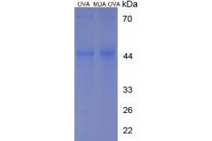 Image no. 2 for Malondialdehyde (MDA) protein (Ovalbumin) (ABIN1880287)