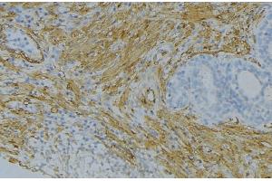 ABIN6274666 at 1/100 staining Human uterus tissue by IHC-P. (FGF18 抗体  (Internal Region))