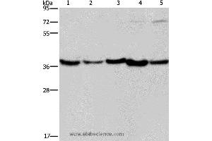 Western blot analysis of Human fetal liver, mouse skeletal muscle and heart tissue, Hela and Jurkat cell, using DNAJB4 Polyclonal Antibody at dilution of 1:200 (DNAJB4 抗体)