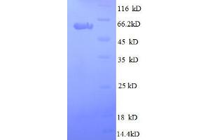 SDS-PAGE (SDS) image for Secreted Protein, Acidic, Cysteine-Rich (Osteonectin) (SPARC) (AA 18-303), (full length) protein (GST tag) (ABIN1047669)