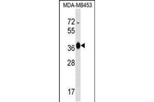 Western blot analysis in MDA-MB453 cell line lysates (35ug/lane). (GFOD2 抗体  (N-Term))