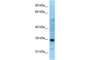 WB Suggested Anti-PROSC Antibody Titration: 1. (PROSC 抗体  (C-Term))
