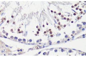 Immunohistochemistry of paraffin-embedded Rat testis using HFM1 Polyclonal Antibody at dilution of 1:100 (40x lens). (HFM1 抗体)