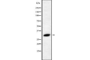 Western blot analysis of RAB40C using HeLa whole cell lysates (RAB40C 抗体)