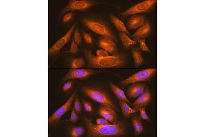 Immunofluorescence analysis of U-2 OS cells using LM Rabbit pAb (ABIN6131613, ABIN6143266, ABIN6143267 and ABIN6214694) at dilution of 1:100 (40x lens). (LMAN1 抗体  (AA 270-480))