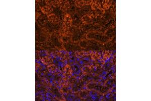 Immunofluorescence analysis of mouse kidney using L Polyclonal Antibody (ABIN6128174, ABIN6143076, ABIN6143077 and ABIN6219002) at dilution of 1:100 (40x lens). (LAMC2 抗体  (AA 862-1111))