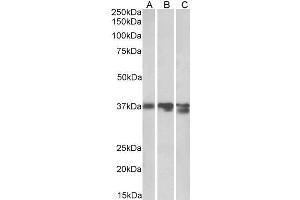 ABIN570917 (0. (Liver Arginase 抗体  (C-Term))