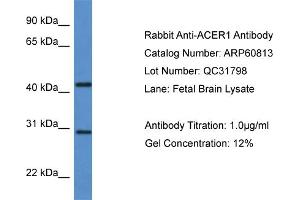 Western Blotting (WB) image for anti-Alkaline Ceramidase 1 (ACER1) (C-Term) antibody (ABIN2788592) (ACER1 抗体  (C-Term))