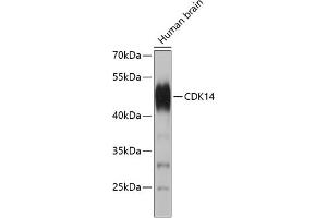 Western blot analysis of extracts of human brain, using CDK14 antibody (ABIN1681332, ABIN3017688, ABIN3017689 and ABIN5664288). (CDK14 抗体)