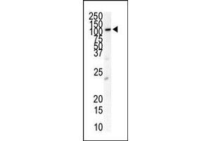 Western blot analysis of anti-FLT3 Pab (ABIN391981 and ABIN2841772) in HL-60 cell lysate. (FLT3 抗体  (N-Term))