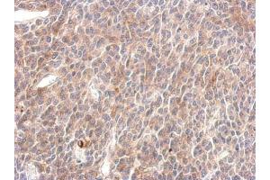 IHC-P Image SHP2 antibody detects PTPN11 protein at cytosol on BT483 xenograft by immunohistochemical analysis. (PTPN11 抗体  (C-Term))