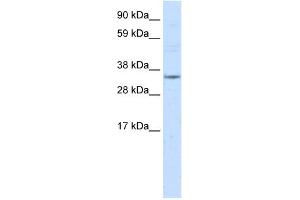 Western Blotting (WB) image for anti-Nuclear Receptor Subfamily 1, Group I, Member 3 (NR1I3) (Middle Region) antibody (ABIN2780298)