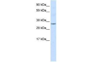 WB Suggested Anti-NR1I3 Antibody Titration:  2. (NR1I3 抗体  (Middle Region))