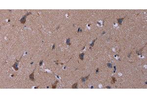 Immunohistochemistry of paraffin-embedded Human brain tissue using TUBGCP2 Polyclonal Antibody at dilution 1:50 (TUBGCP2 抗体)