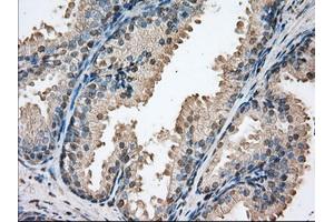 Immunohistochemical staining of paraffin-embedded Human colon tissue using anti-PIM2 mouse monoclonal antibody. (PIM2 抗体)