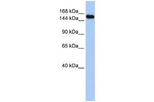 UBE3A antibody used at 1 ug/ml to detect target protein. (ube3a 抗体  (Middle Region))