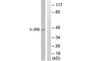Western blot analysis of extracts from Raw264. (CSF2RB2 抗体  (AA 559-608))