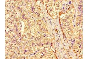Immunohistochemistry of paraffin-embedded human adrenal gland tissue using ABIN7158780 at dilution of 1:100 (CTSA 抗体  (AA 30-327))