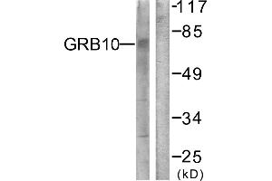 Immunohistochemistry analysis of paraffin-embedded human brain tissue using GRB10 (Ab-67) antibody. (GRB10 抗体)