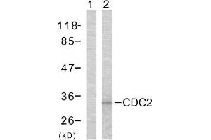 Western blot analysis of the extracts from COLO cells using CDC2 (Ab-161) antibody (E021152). (CDK1 抗体)