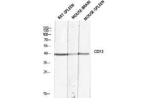Western Blot (WB) analysis of Rat Spleen Mouse Brain Mouse Spleen lysis using CD72 antibody. (CD72 抗体)