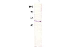 Western Blot testing of anti-BPV E2 monoclonal antibody (3F12). (Bovine Papilloma Virus 1 E2 (BPV-1 E2) (AA 197-208) 抗体)