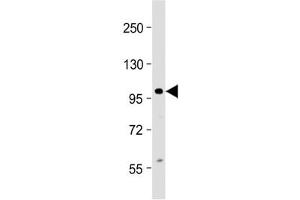 Western blot testing of human Jurkat cell lysate with CIP2A antibody at 1:2000. (KIAA1524 抗体  (AA 537-567))
