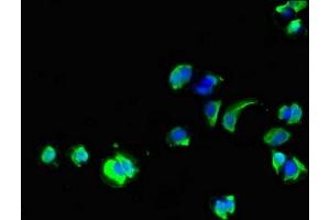 Immunofluorescent analysis of MCF-7 cells using ABIN7154264 at dilution of 1:100 and Alexa Fluor 488-congugated AffiniPure Goat Anti-Rabbit IgG(H+L) (GPC1 抗体  (AA 342-530))