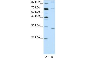 WB Suggested Anti-ATOH8 Antibody Titration:  2. (ATOH8 抗体  (N-Term))
